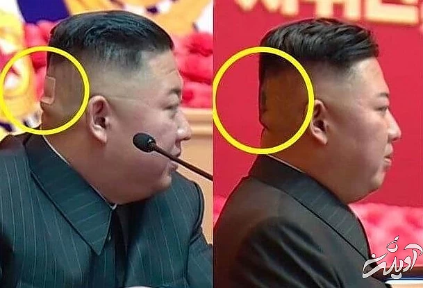 مرگ «کیمجونگاون» و یک فاجعه هستهای مرگ «کیمجونگاون» و یک فاجعه هستهای